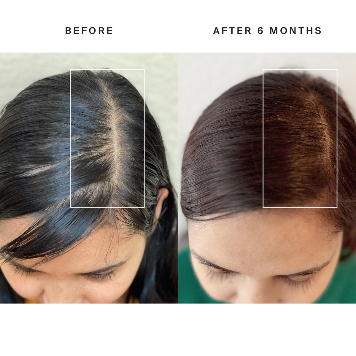Relievora HairRevive™ Therapy Cap
